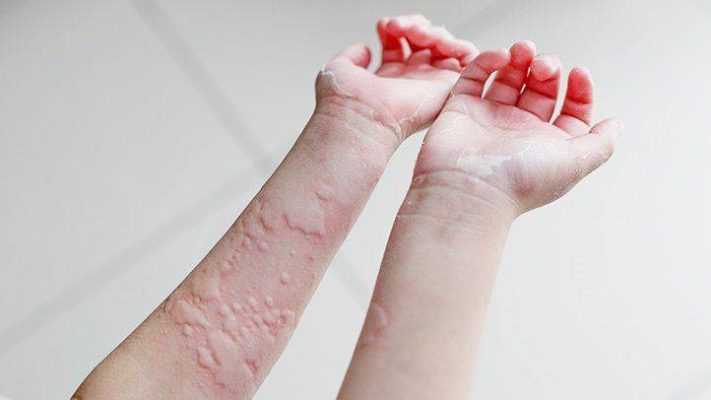 اسباب ظهور الحشرات فى المنزل